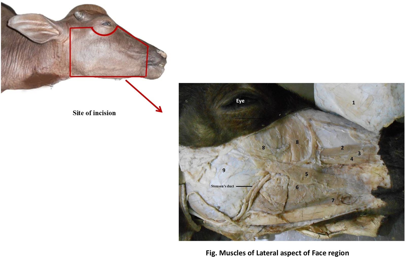 Lateral Aspect of Face — Dissection overview displaying facial mimetic muscles with surgical callouts and incision reference