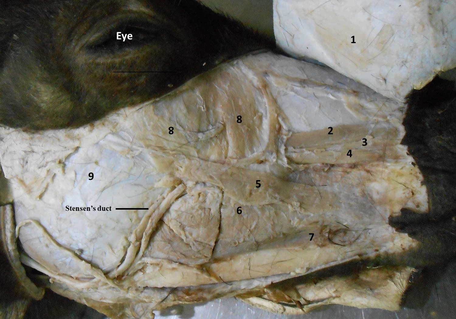 Facial Musculature — Close-up gross dissection showing masseter, zygomaticus, buccinator, and facial vessels