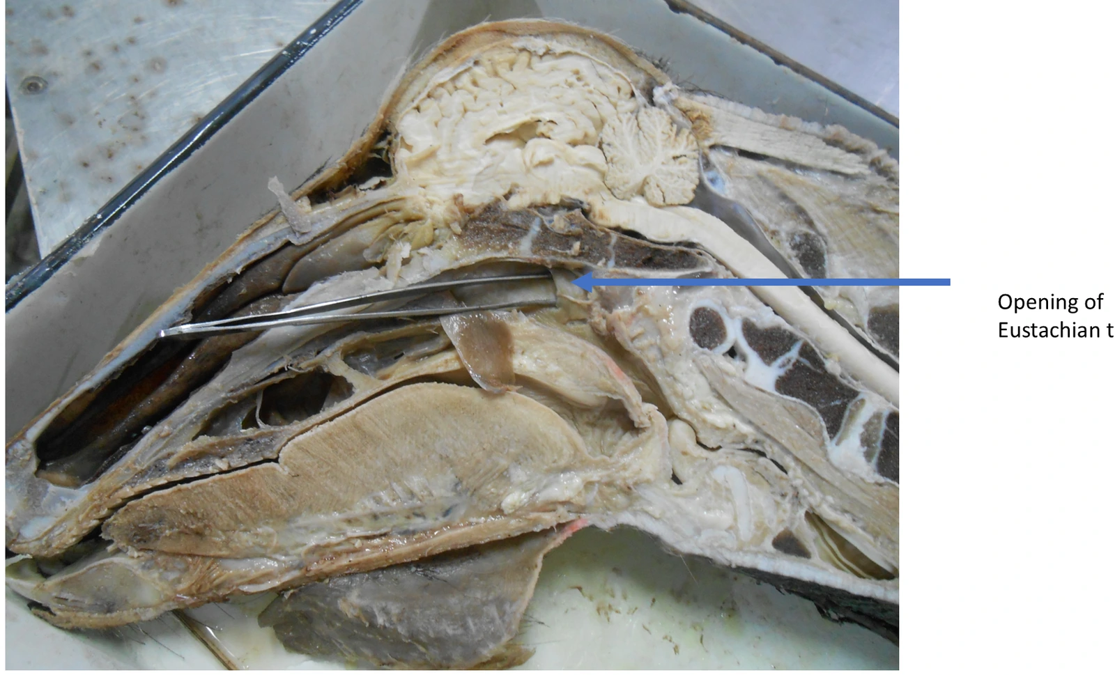 Auditory (Eustachian) Tube — Pharyngeal ostium opening into the nasopharynx for tympanic pressure equalization