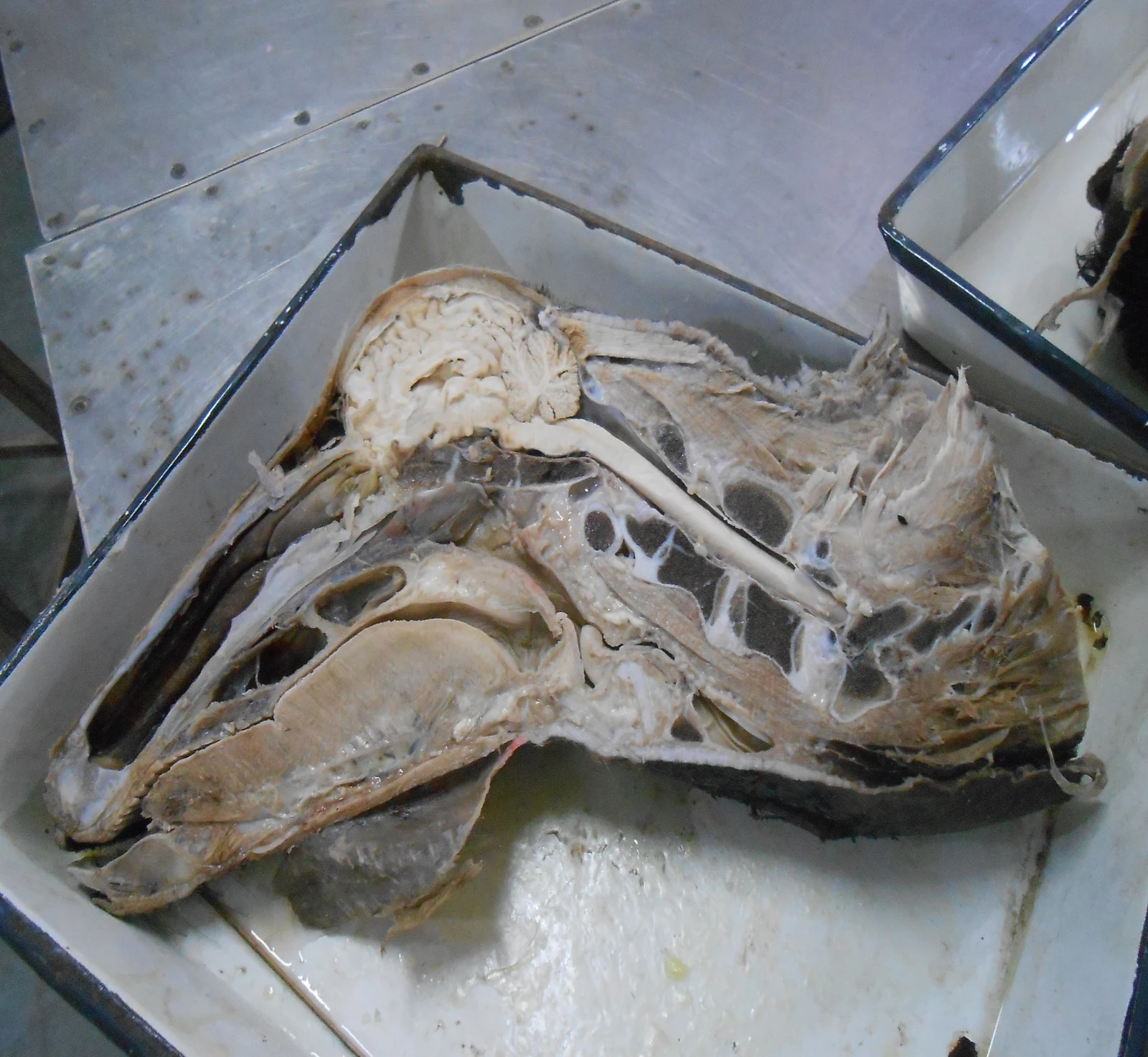Craniofacial Architecture — Median sagittal section demonstrating oral cavity, pharyngeal crossroads, larynx, and tongue