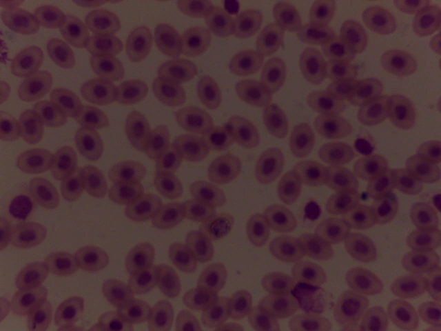 Avian Blood Smear — 40x: Nucleated erythrocytes and avian heterophil with rod-shaped granules