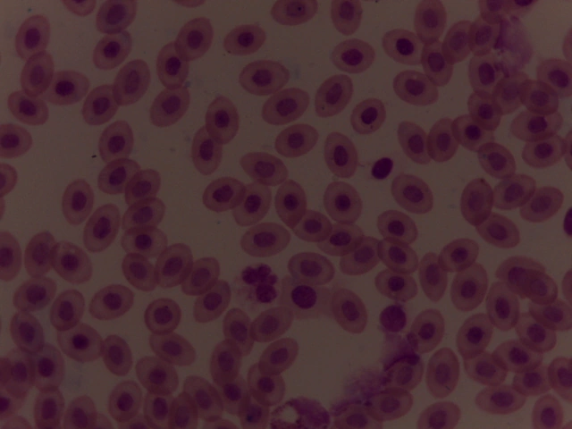 Avian Blood Smear — 40x: Comparative demonstration of nucleated avian RBCs vs mammalian RBCs
