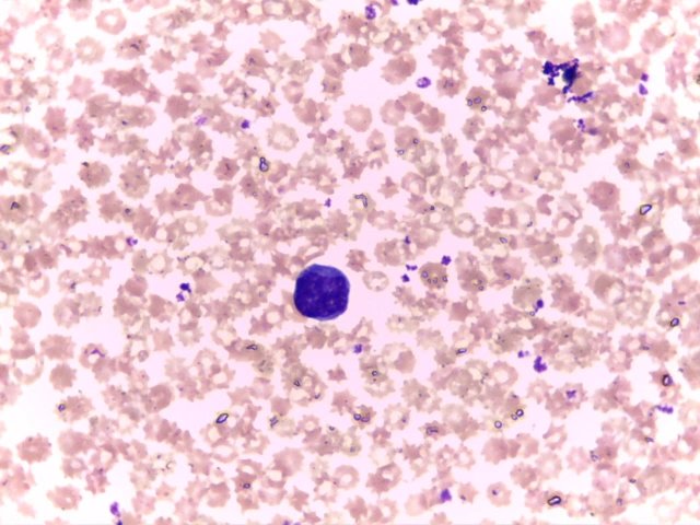 Bovine Blood Smear — Leishman Stain: Small anucleate erythrocytes and predominant lymphocytes