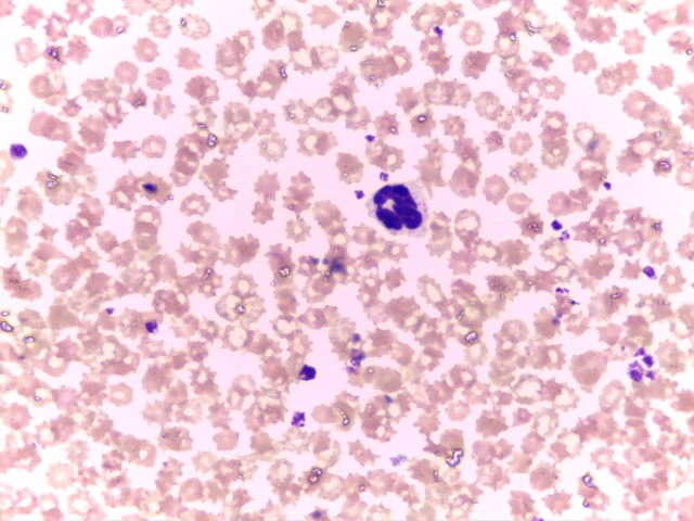 Bovine Blood Smear — High power field demonstrating characteristic ruminant lymphocytic leukogram