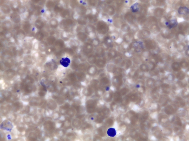 Canine Blood Smear — Biconcave erythrocytes showing prominent central pallor and segmented neutrophils