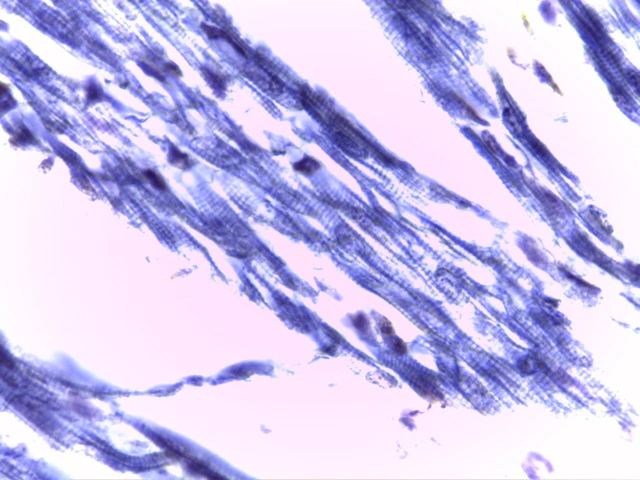 Cardiac Muscle — Striated branching myofibres with central oval nuclei and intercalated discs