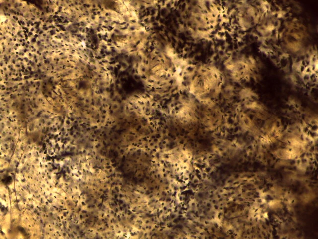 Compact Bone — 40x: Haversian system (osteon) with central canal and concentric lamellae