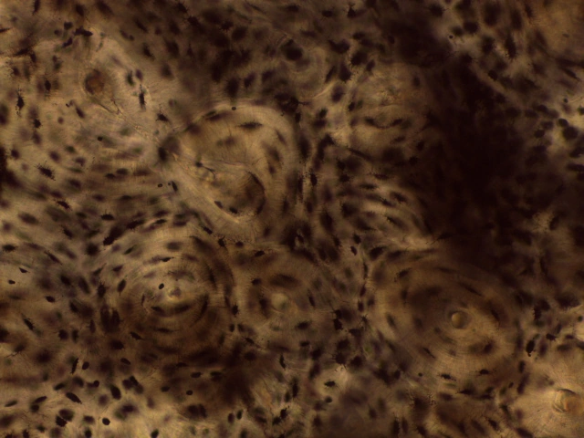 Compact Bone — 40x: Osteocyte lacunae arranged concentrically around Haversian canal