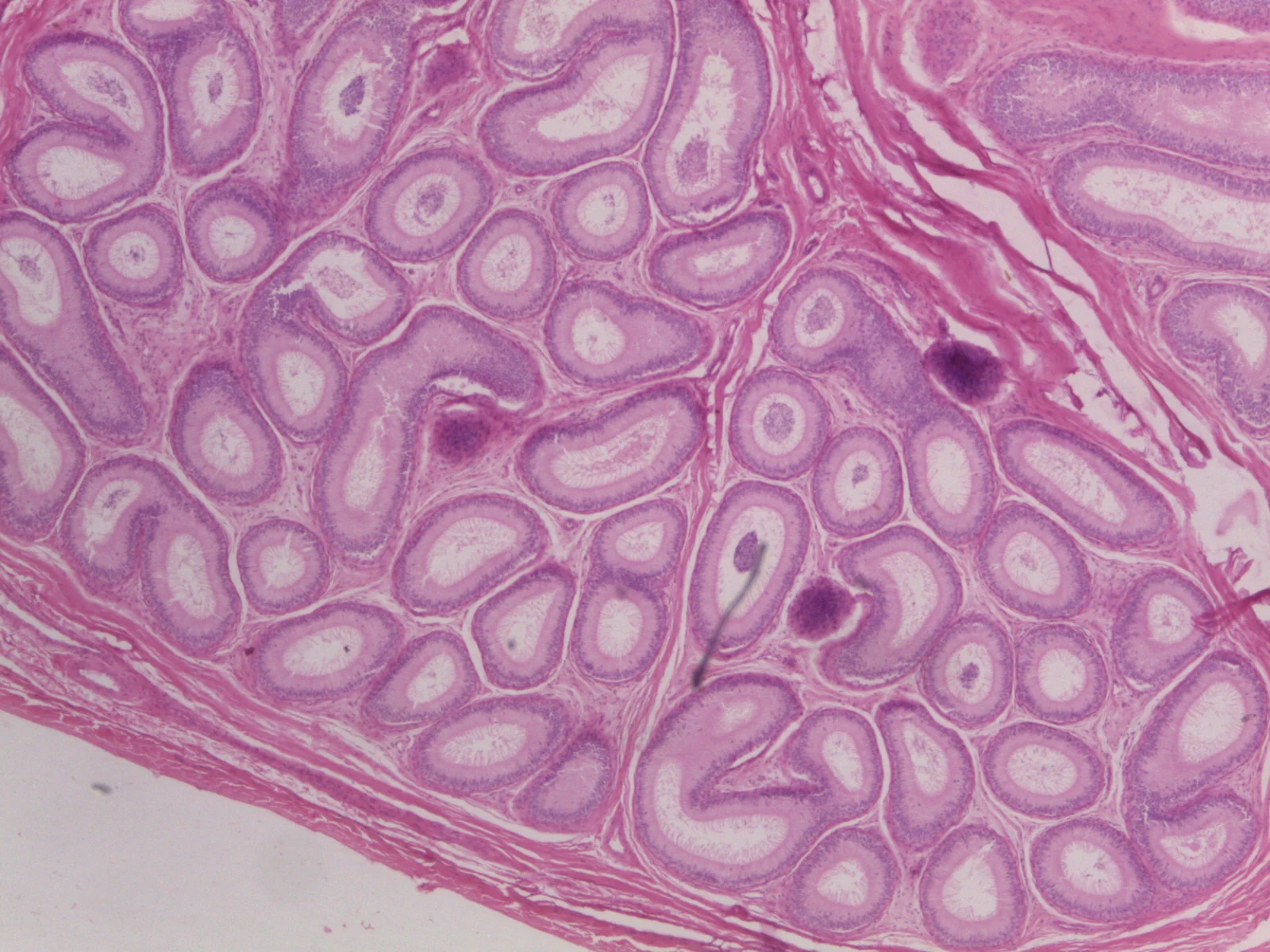Epididymis — 4x: Cross-sections of the highly coiled ductus epididymidis surrounded by smooth muscle and vascular stroma