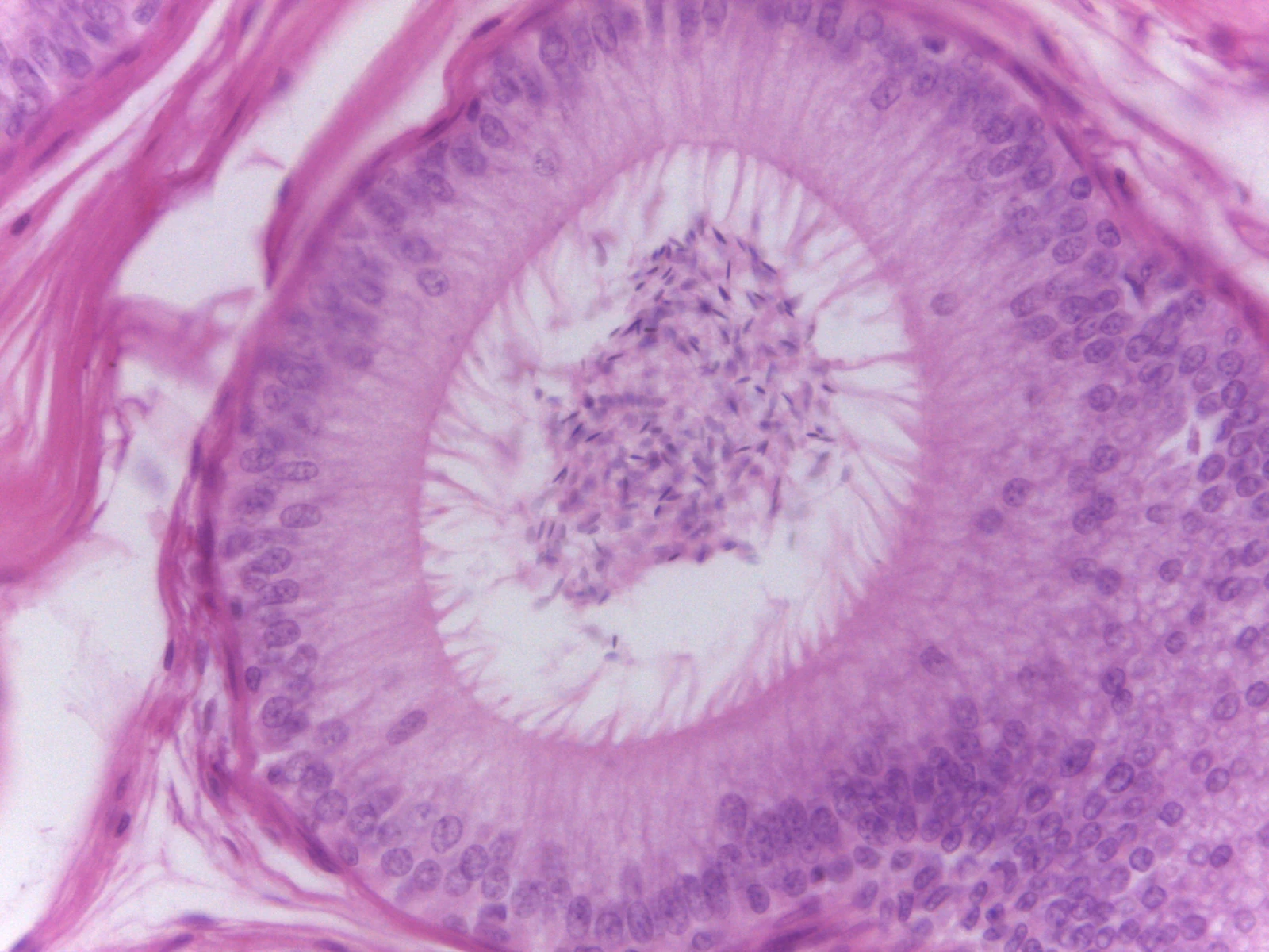 Surface Specializations — 40x High Power: Pseudostratified columnar epithelium exhibiting long non-motile stereocilia
