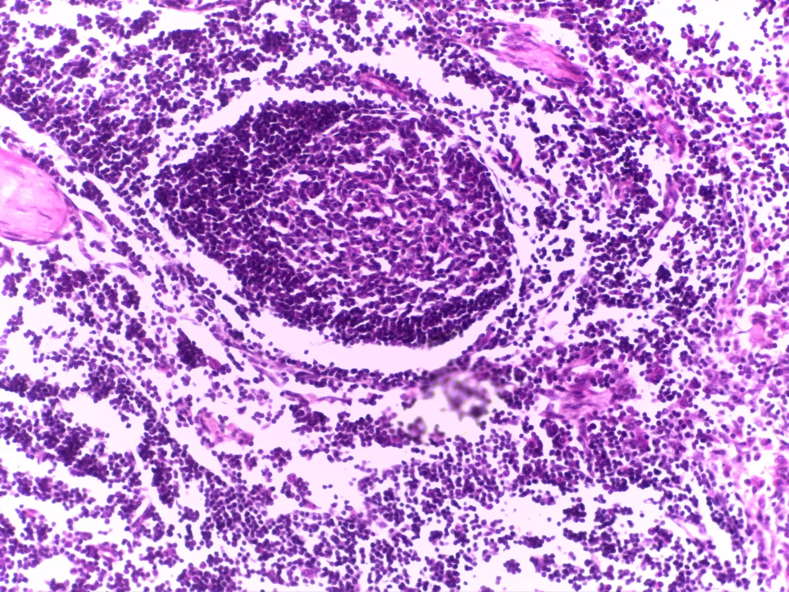 Lymph Node Cortex — 20x: Fibrous capsule, subcapsular sinus, and primary/secondary lymphoid follicles