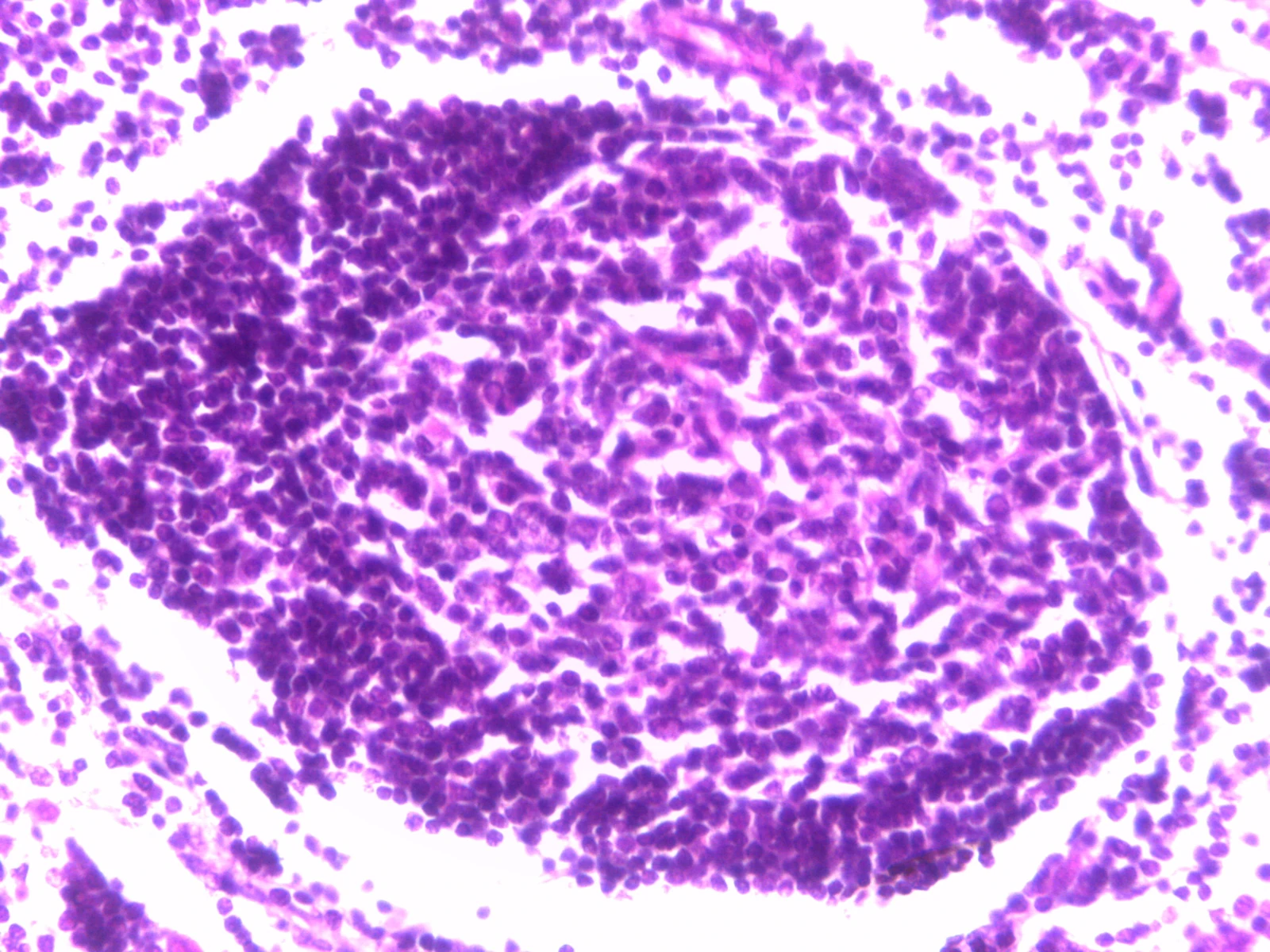 Lymph Node Cortex — 40x: Secondary lymphoid follicle with pale active germinal centre, mantle zone, and proliferating B-lymphocytes