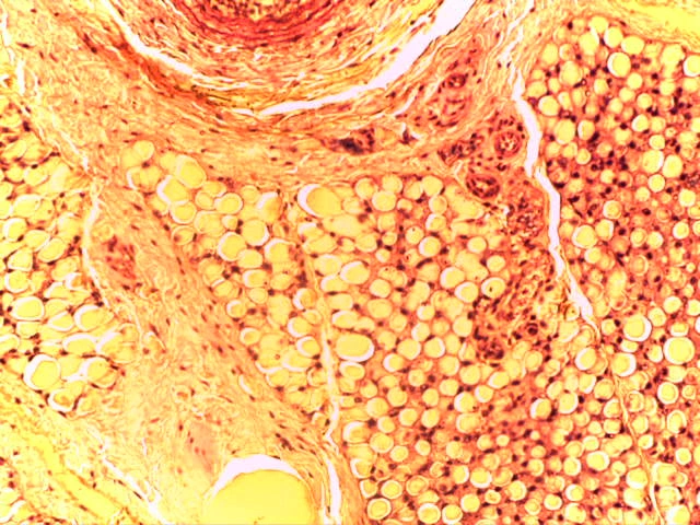 Microvasculature — 40x: Small capillary/venule lined by endothelium with associated pericyte