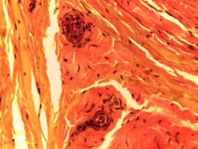 Smooth Muscle — 40x High Power: Concentric sheets of fusiform smooth muscle cells with elongated nuclei in tunica media