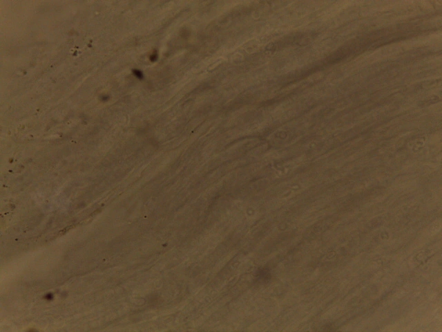 Nerve Ganglion — Neuronal cell bodies (perikarya) clustered within supporting connective tissue stroma