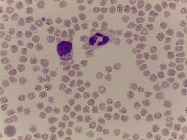 Ovine Blood Smear — Small round erythrocytes and circulating ruminant leukocytes