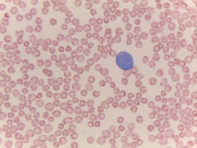 Ovine Blood Smear — Giemsa Stain: Stained erythrocyte morphology and lymphocytic predominance