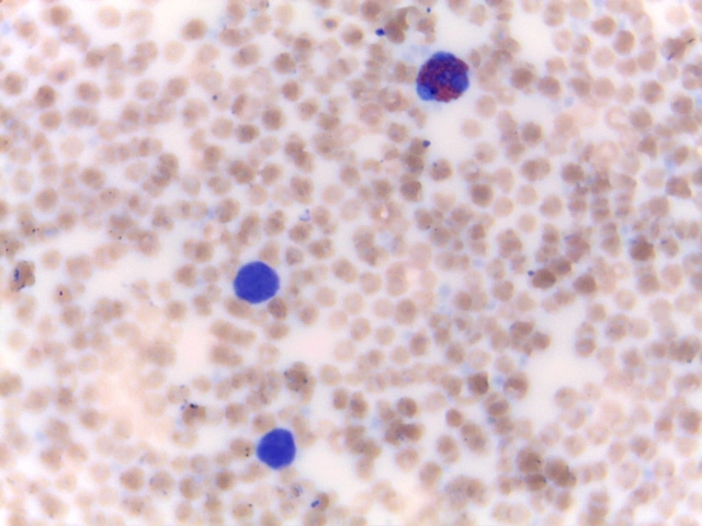 Ovine Blood Smear — 40x Leishman Stain: Ovine red blood cells and polymorphonuclear leukocyte