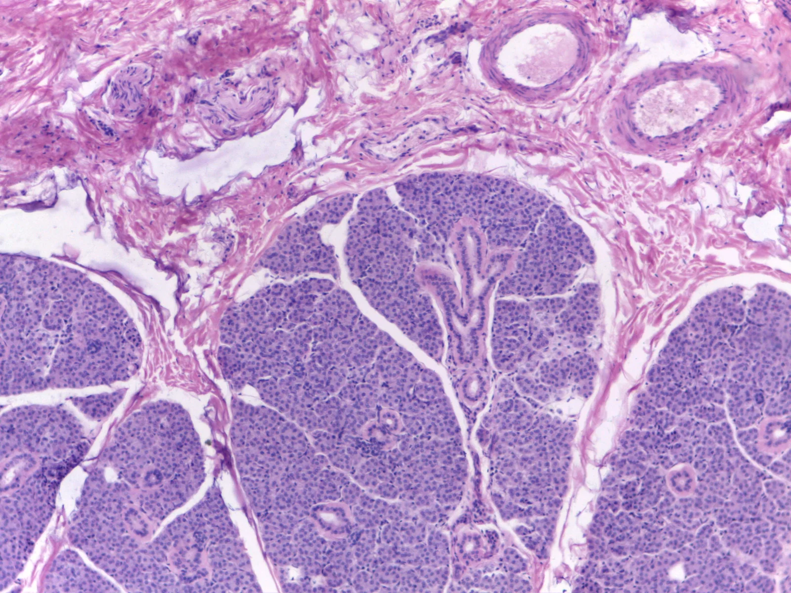 Parotid Gland — 10x: Lobular architecture separated by connective tissue septa with intralobular ducts