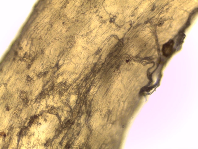 Peripheral Nerve — 20x: Nerve fascicle wrapped by perineurium with individual axon fibres in endoneurium