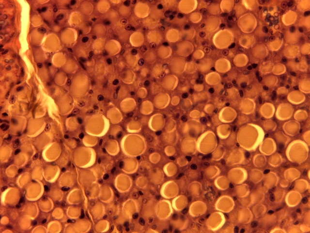 Perivascular Tissues — 40x: Unilocular adipocytes and supportive adventitial loose connective tissue