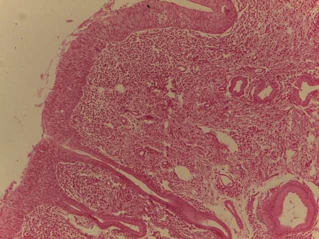 Trachea — 10x Medium Power: Respiratory epithelium and lamina propria