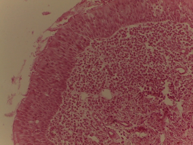 Trachea — 20x Intermediate Power: Nuclei at varying levels resting on basement membrane