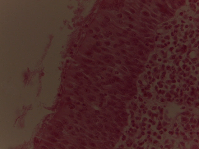 Trachea — 40x High Power: Pseudostratified ciliated columnar cells with prominent goblet cells & cilia