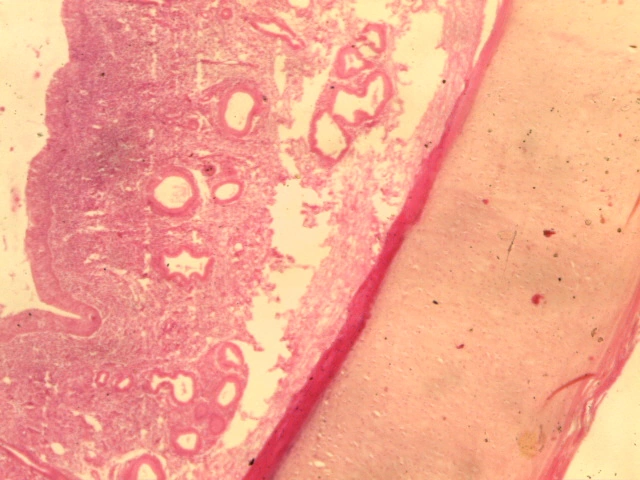 Trachea — 4x Low Power: Respiratory mucosa and underlying hyaline cartilage
