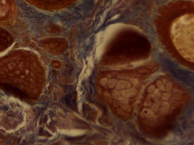 Sebaceous Glands — 40x: Lipid-filled foamy polyhedral cells with central pyknotic nuclei demonstrating holocrine secretion