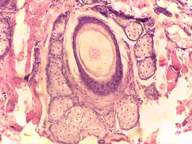 Sebaceous Glands — 20x: Simple branched acinar glands associated with hair follicles discharging sebum