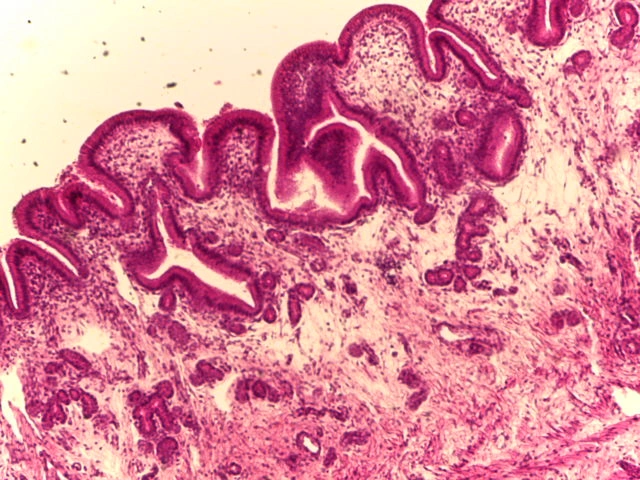 Gall Bladder — 10x Medium Power: Tall columnar cells on lamina propria