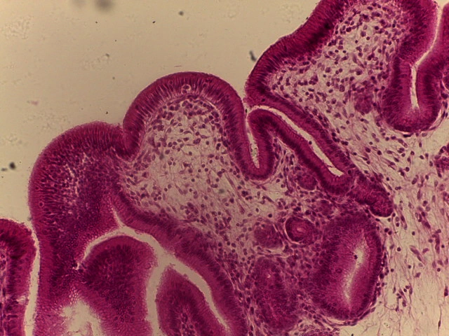 Gall Bladder — 20x Intermediate Power: Oval basal nuclei with apical brush border