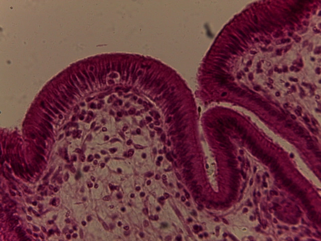 Gall Bladder — 40x High Power: Simple columnar epithelial cells with distinct striated border