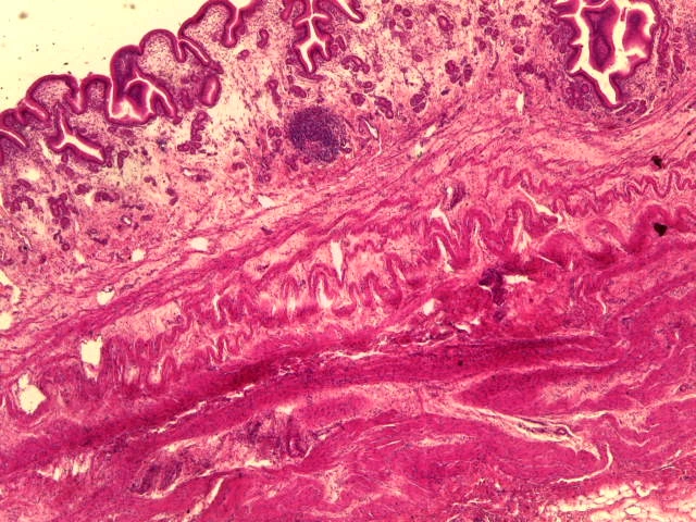 Gall Bladder — 4x Low Power: Simple columnar epithelium lining mucosal folds