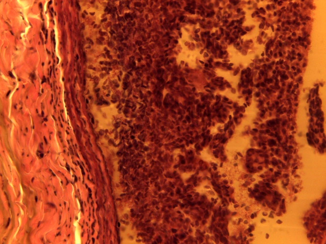 Vein — 40x: Wide irregular lumen, thin tunica media, and well-developed tunica adventitia